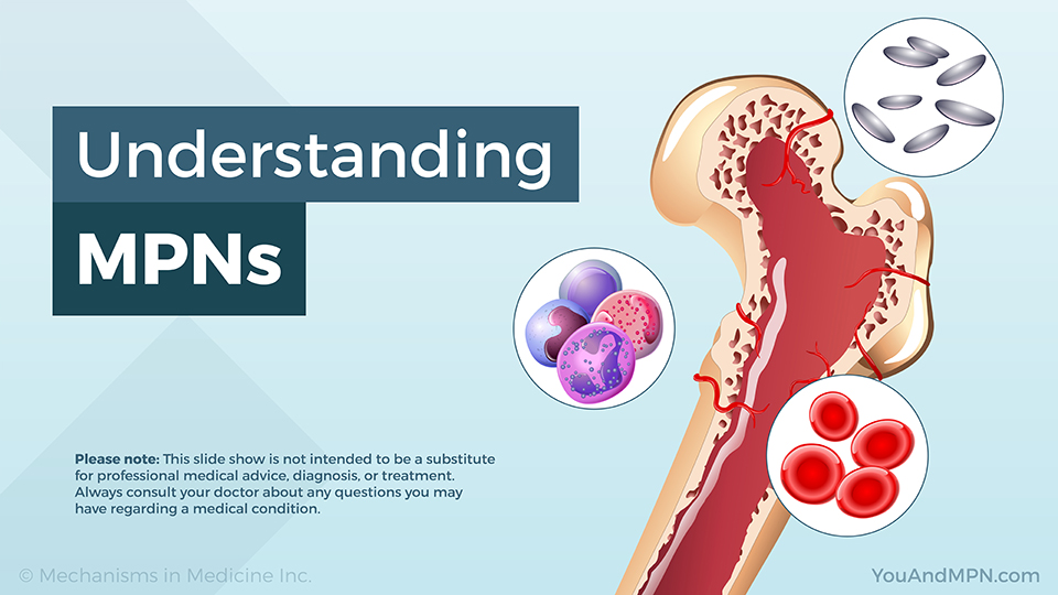Understanding MPNs — Slide Show