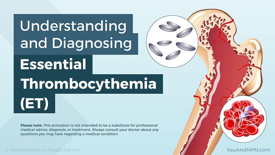 Understanding and Diagnosing Essential Thrombocythemia (ET) — Animation