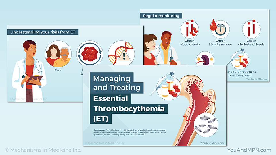Managing and Treating Essential Thrombocythemia (ET) — Slide Show