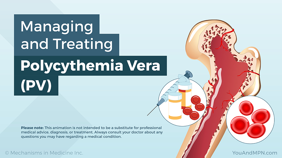 Managing and Treating Polycythemia Vera (PV) — Animation