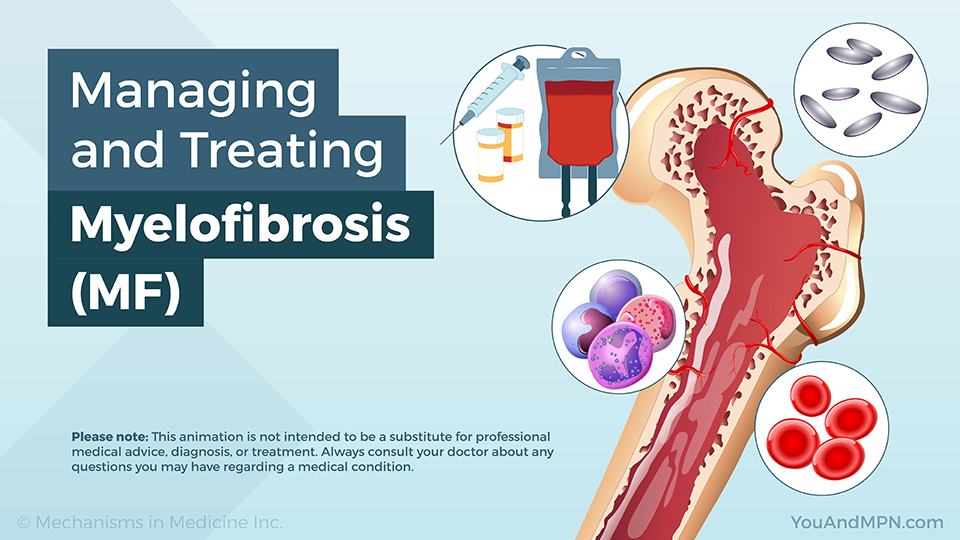 Managing and Treating Myelofibrosis (MF) — Animation